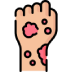 Skin Diseases